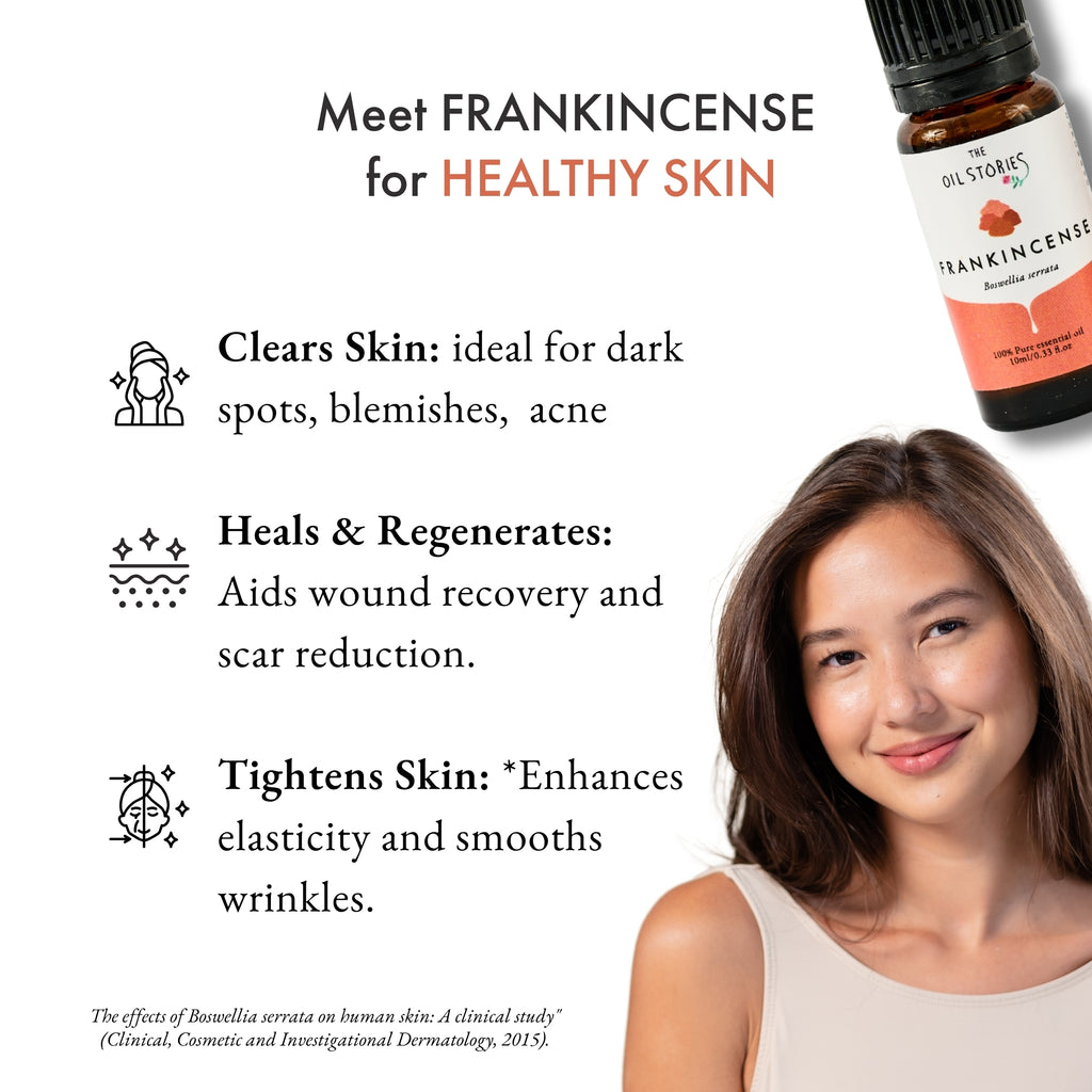 Frankincense Essential Oil